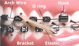 Orthodontic Chart